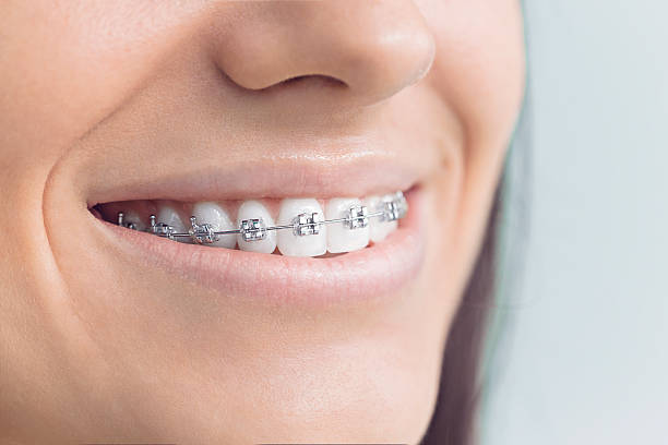 Best Wisdom Tooth Removal  in North East, MD